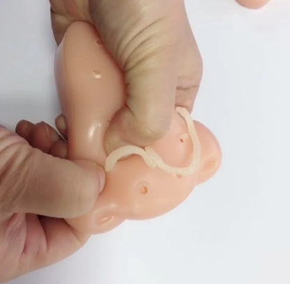 Acne Squeeze Simulator