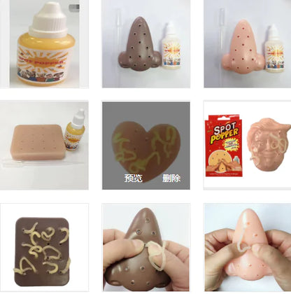 Acne Squeeze Simulator